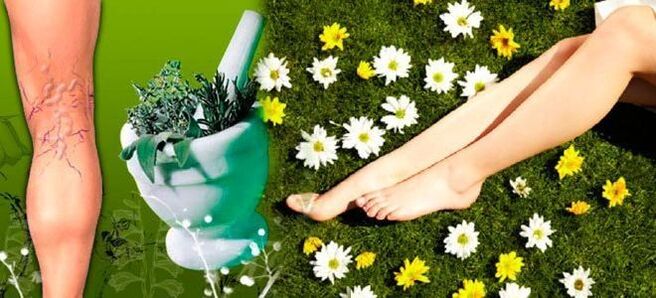 Folk remedies for varicose veins in the legs, which promotes rapid recovery